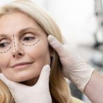 Десять обязательных вопросов, которые нужно задать пластическому хирургу перед операцией
