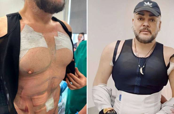Хочу пресс как у Киркорова: поможет ли пластика сделать &laquo;кубики&raquo; без спорта и диет